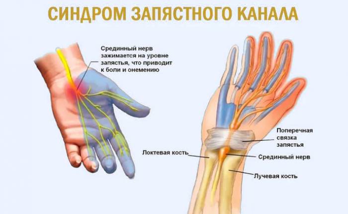 Как узнать состояние здоровья по руке