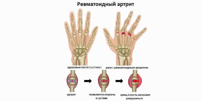 Как узнать состояние здоровья по руке