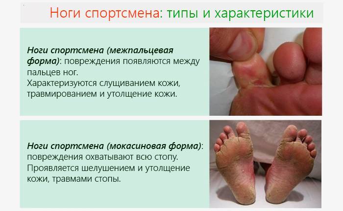 Симптомы заболеваний по состоянию ног