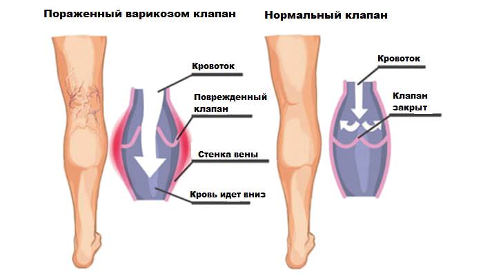Симптомы заболеваний по состоянию ног