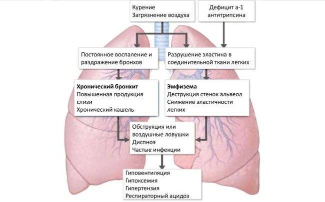 Причини та лікування хронічної обструктивної хвороби легень