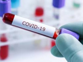 Что вам следует делать, если у вас бессимптомный COVID-19