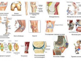 7 причин боли в колене, которые нельзя оставлять без лечения