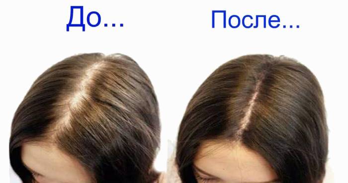 Волосы до и после применения шампуня против выпадения