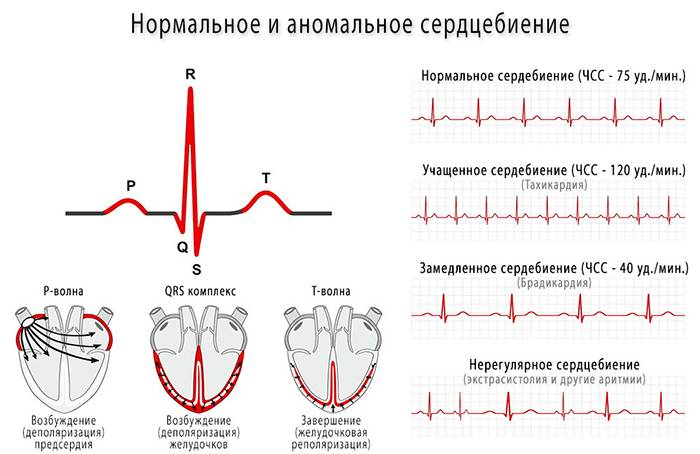 Нормальное и аномальное сердцебиение 