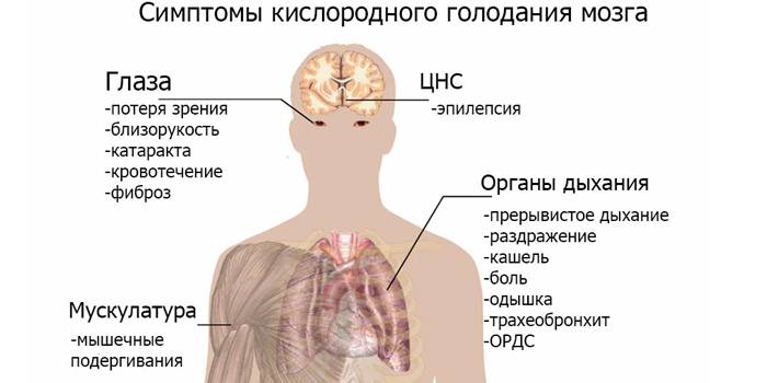 Симптомы кислородного голодания мозга
