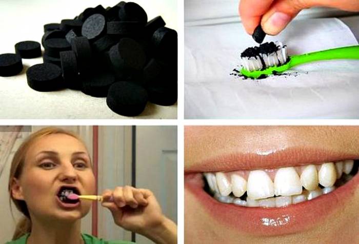 Применение активированного угля для чистки зубов