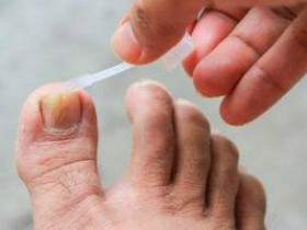 Топ-10 недорогих средств от грибка ногтей