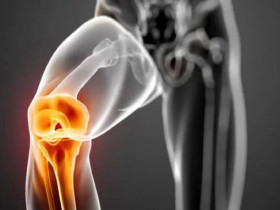 10 способов, как снять боль в колене без лекарств
