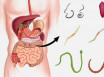 7 симптомов, что у вас завелись глисты