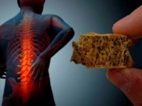 7 продуктов, которых следует избегать при остеопорозе