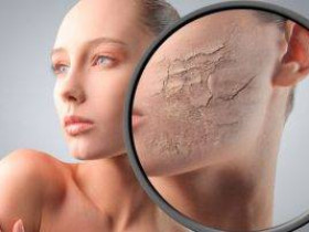 5 причин, по которым кожа на вашем лице может шелушиться