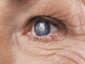 7 признаков катаракты, о которых важно знать