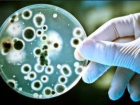 Что убивает микробы и бактерии