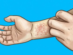 15 болезней, которые можно определить по вашим рукам