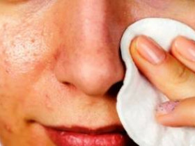 10 лучших советов по очищению жирной кожи