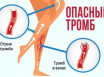 6 признаков указывающих на тромб в ногах