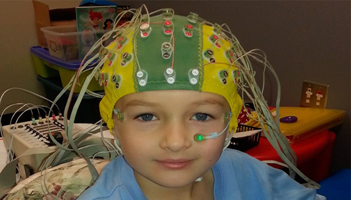 Ребенку делают ЭЭГ головного мозга