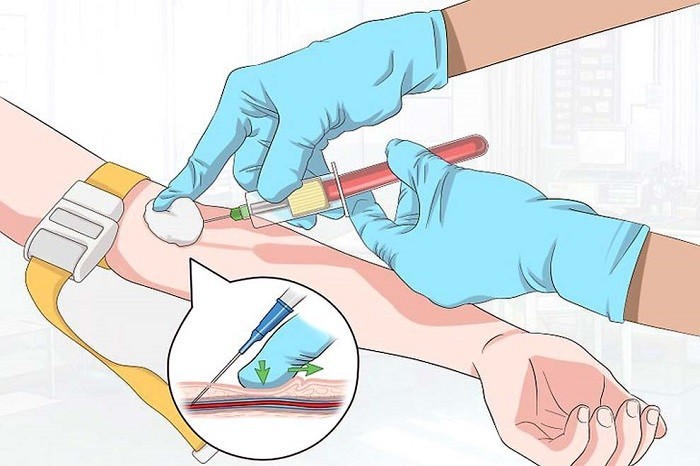 Как берут кровь из вены
